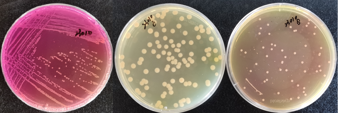 制藥行業(yè)中的隱形殺手-洋蔥伯克霍爾德菌群 制藥行業(yè)中的隱形殺手-洋蔥伯克霍爾德菌群