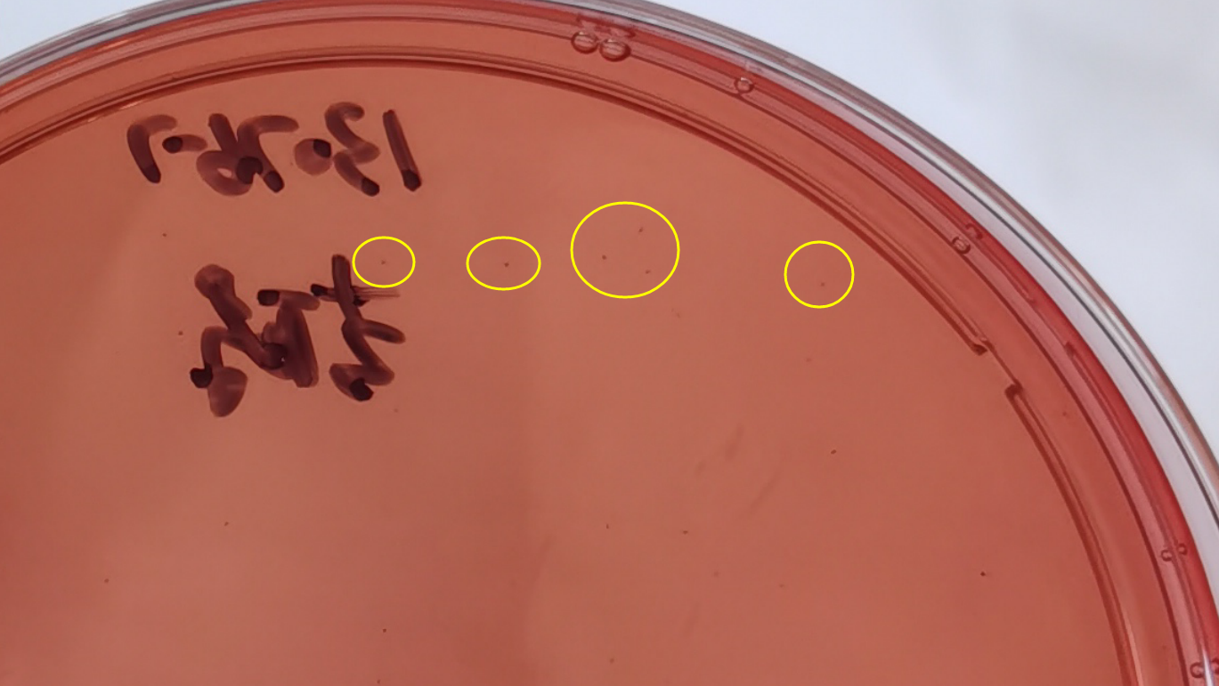 VRBA內(nèi)的紅色小菌落，有可能是沙門氏菌？