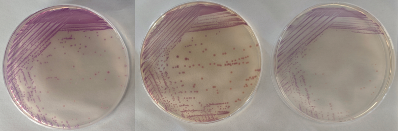 沙門檢測新助手—沙門氏+顯色培養(yǎng)基 沙門檢測新助手—沙門氏+顯色培養(yǎng)基