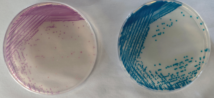 沙門檢測新助手—沙門氏+顯色培養(yǎng)基 沙門檢測新助手—沙門氏+顯色培養(yǎng)基