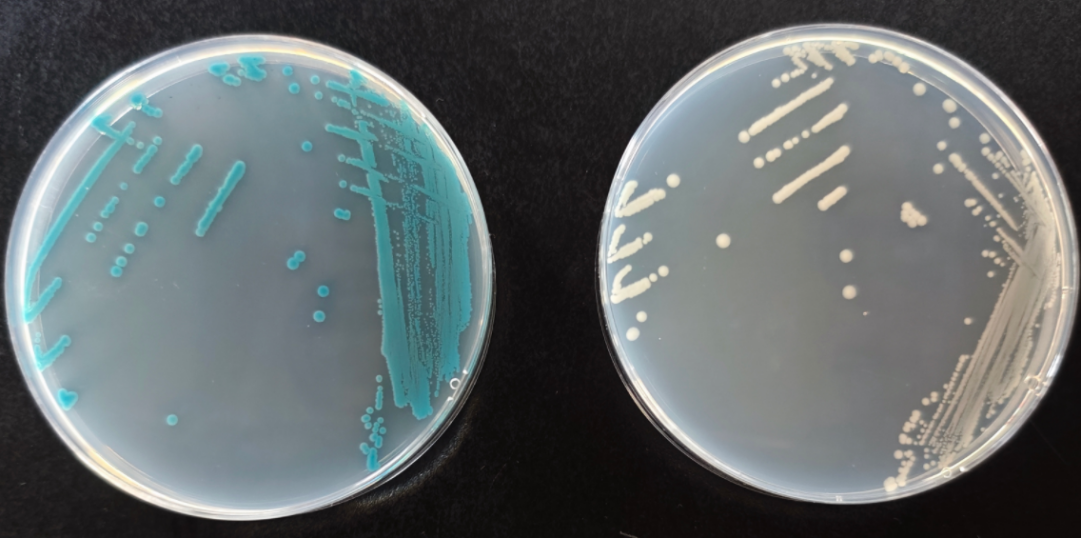 沙門檢測新助手—沙門氏+顯色培養(yǎng)基 沙門檢測新助手—沙門氏+顯色培養(yǎng)基