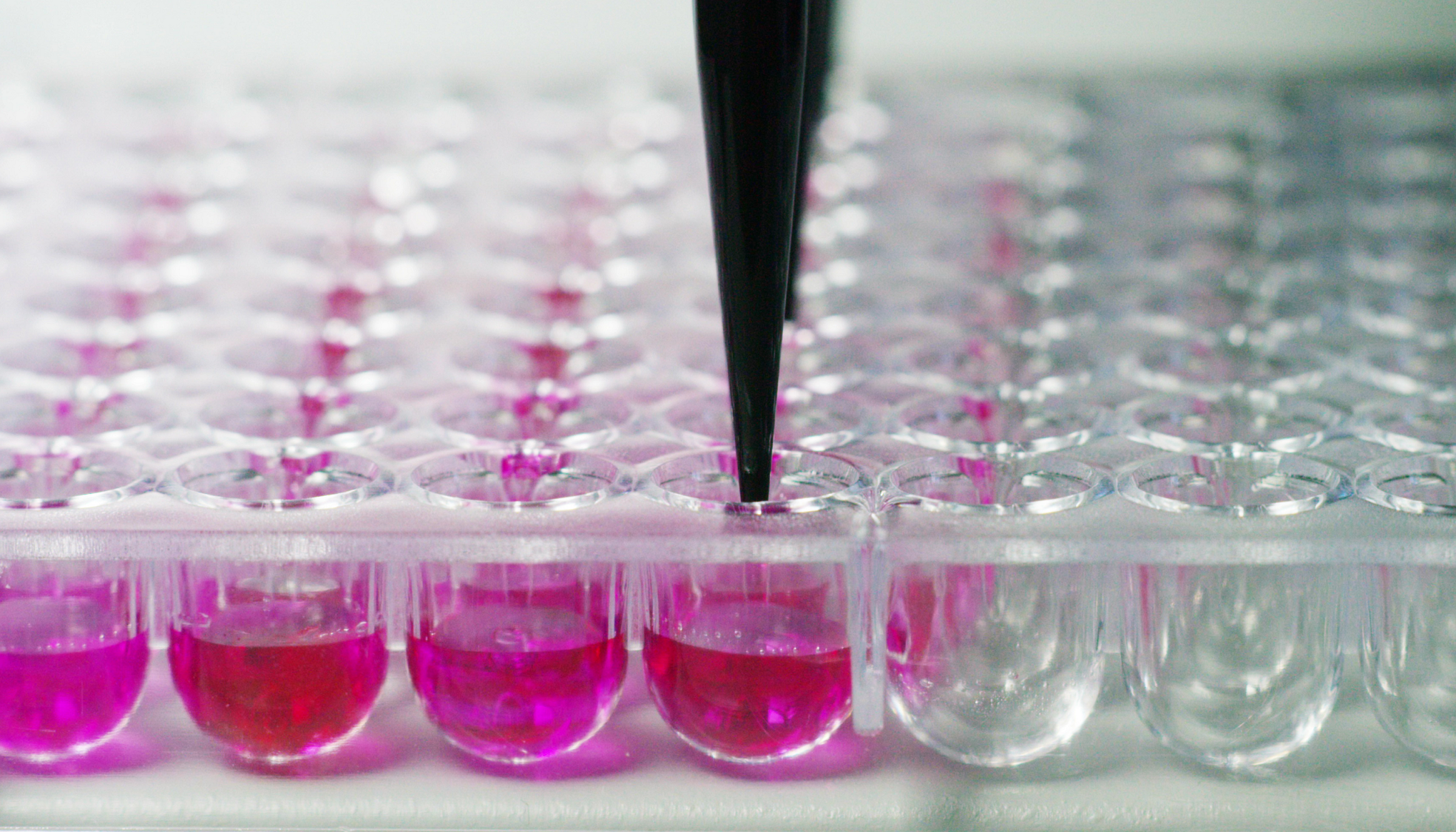 福氏志賀氏菌“靛基質(zhì)試驗(yàn)”的結(jié)果討論